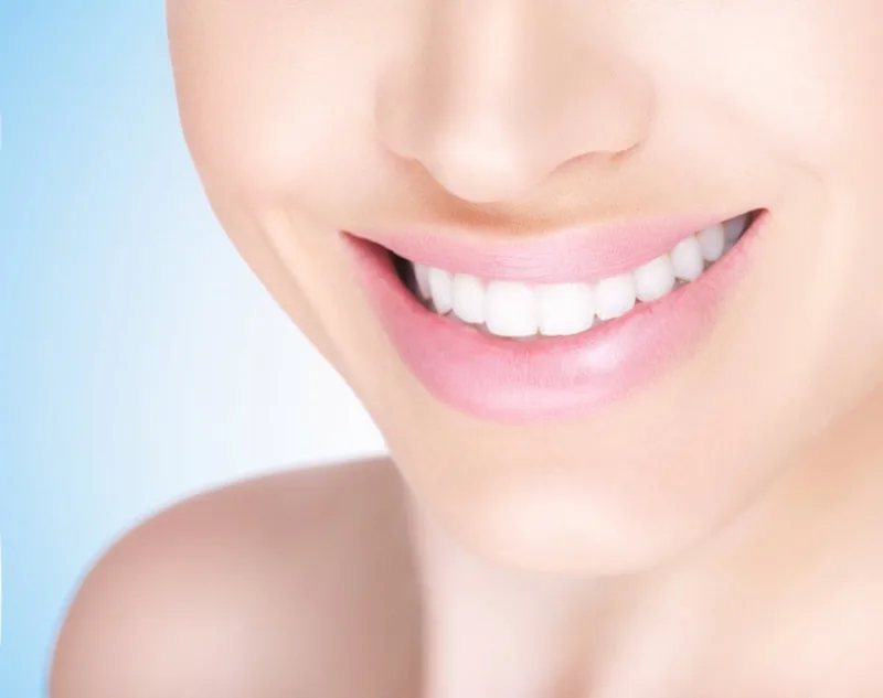 Healthy, bright smile